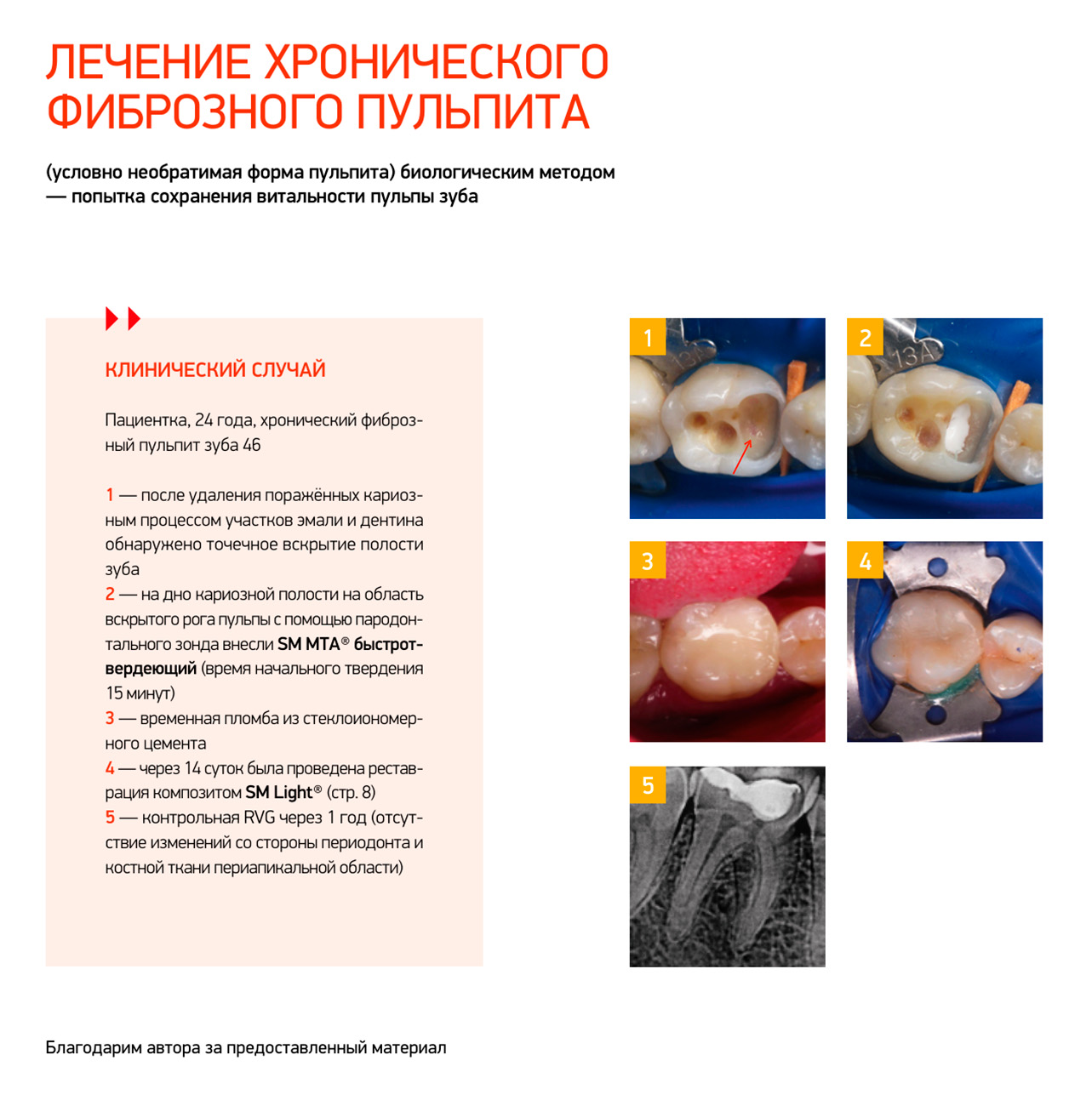 СМ_МТА_клинсл